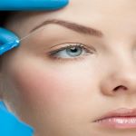 Kaş Kaldırma (Brow Lift)