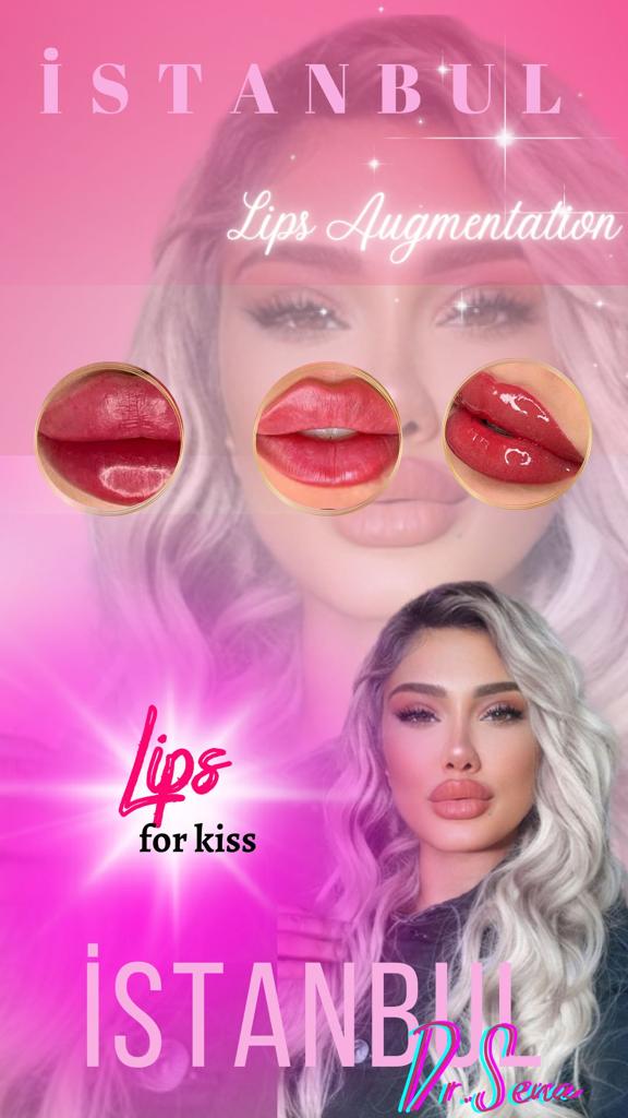 Russian Lips Dudak Dolgusu